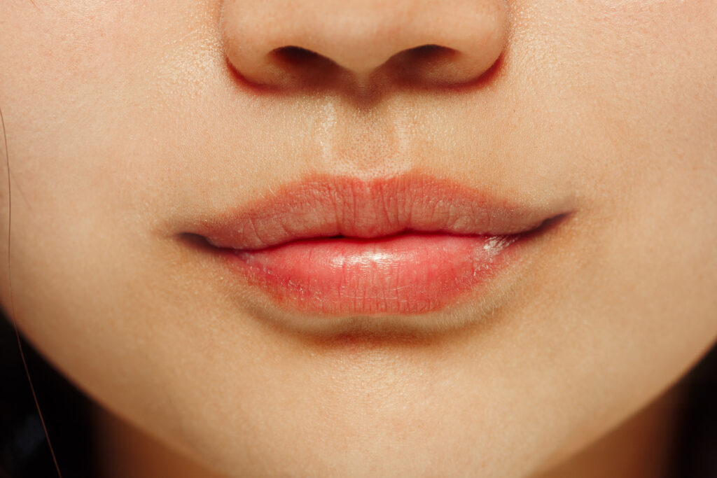 cara menghilangkan kerutan di bibir (1)