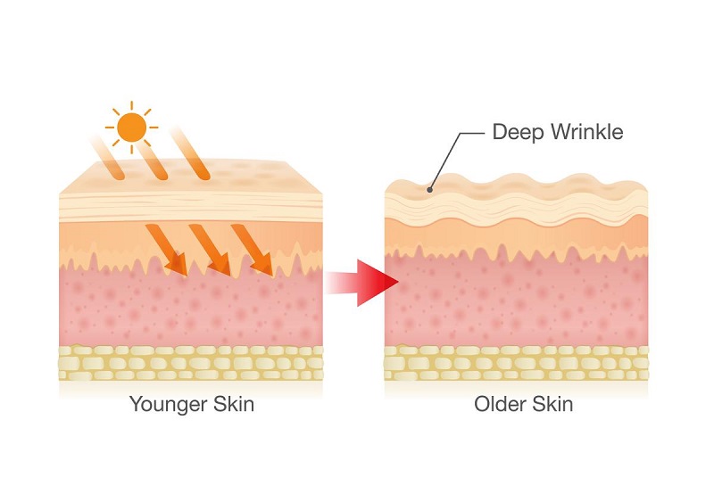 photoaging work