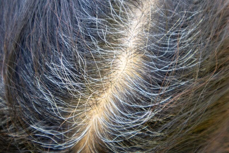 penyebab penuaan dini pada rambut (1)