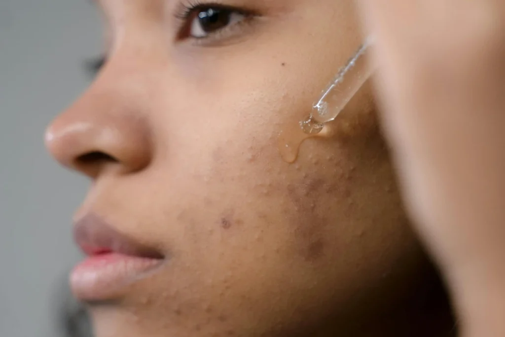 cara mempercepat masa purging