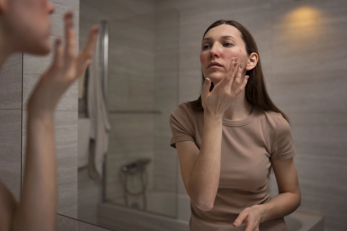 kandungan skincare untuk rosacea
