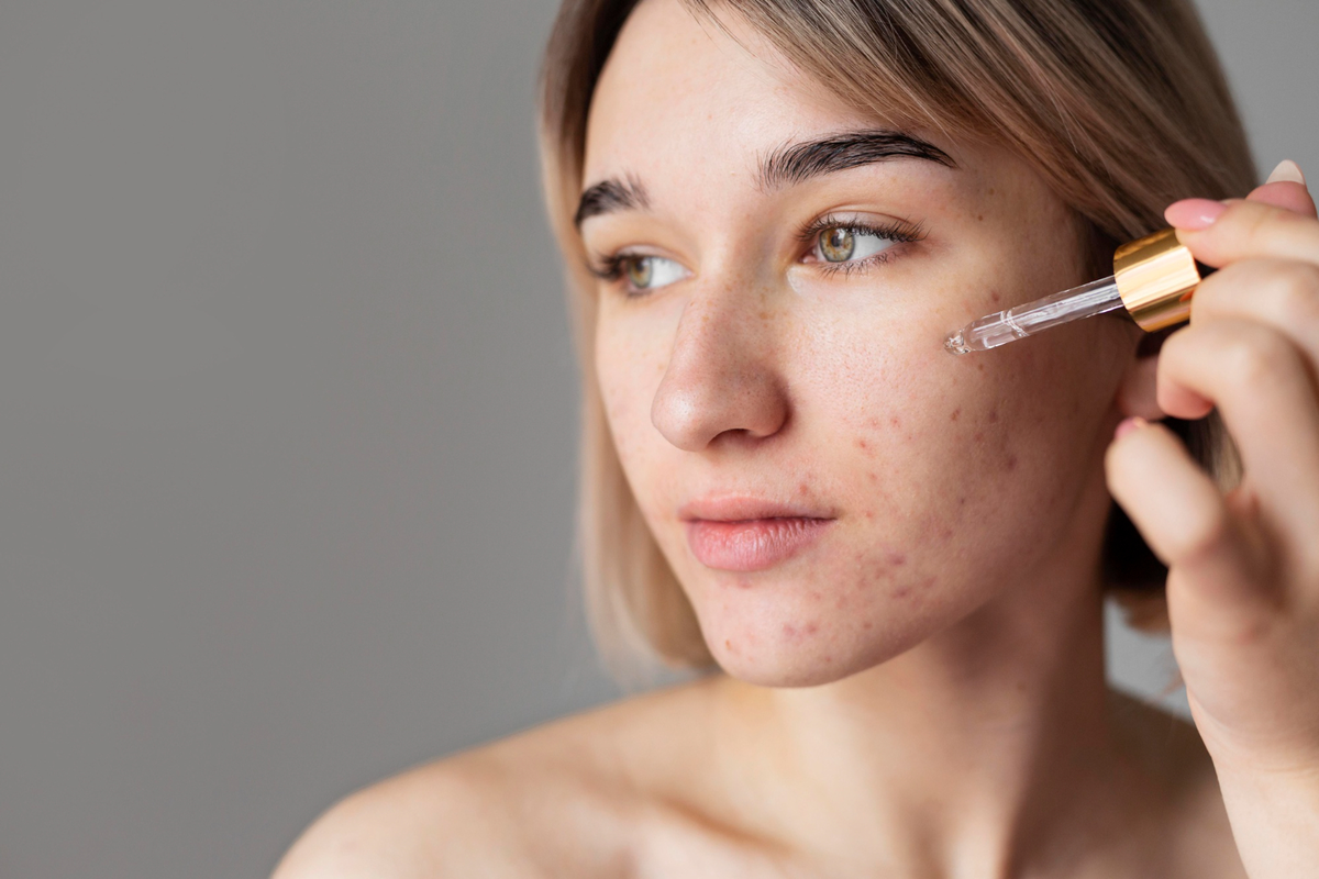 apakah ceramide bisa menghilangkan bekas jerawat