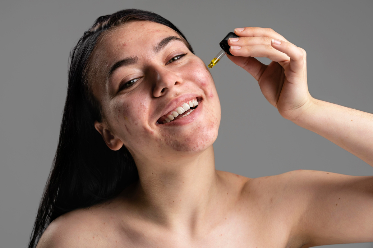 apakah ceramide bisa menghilangkan bruntusan