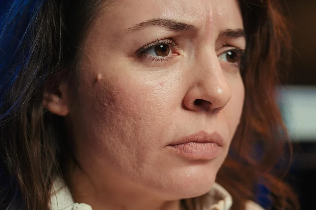 ciri ciri sel kulit mati pada wajah