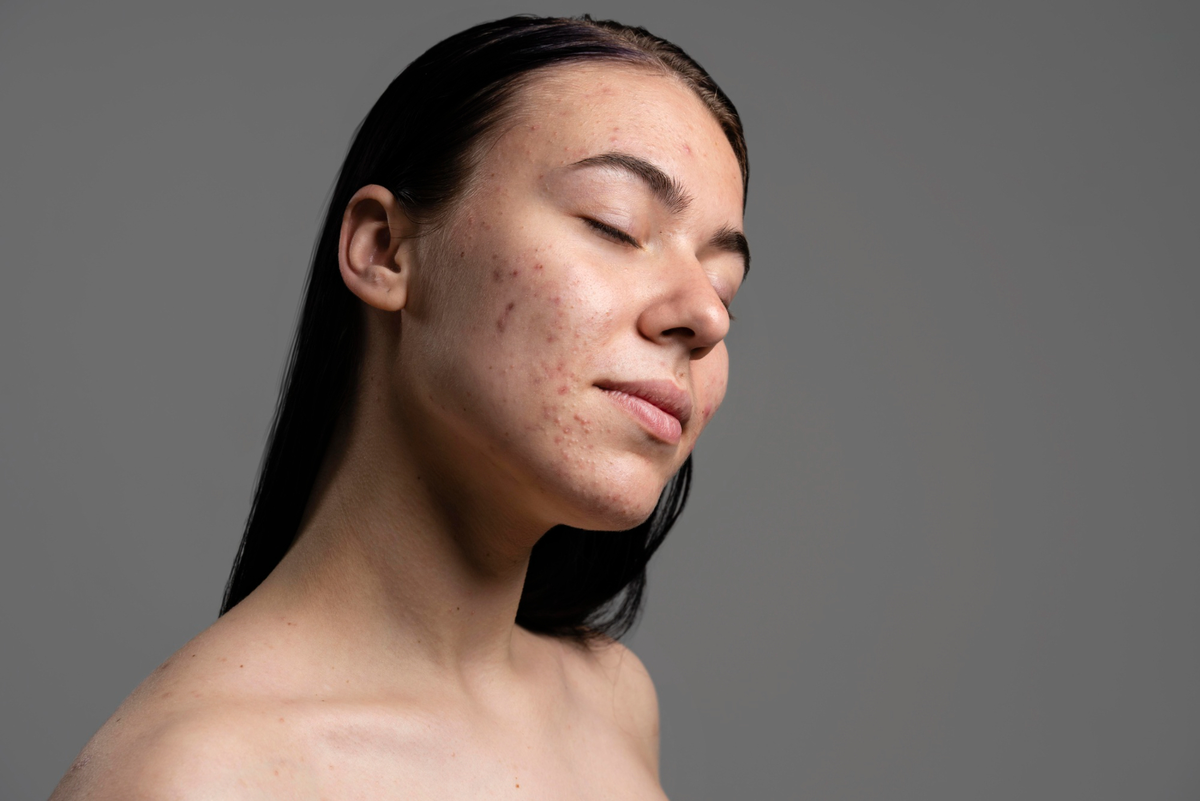 ciri ciri alergi skincare