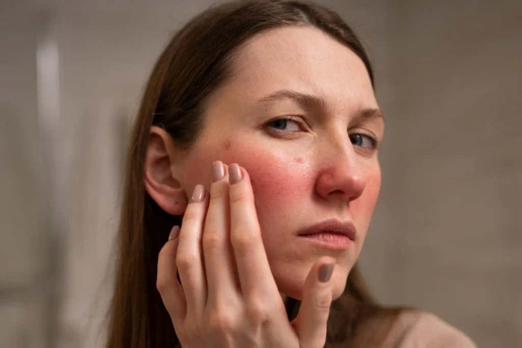 ciri-ciri tidak cocok niacinamide