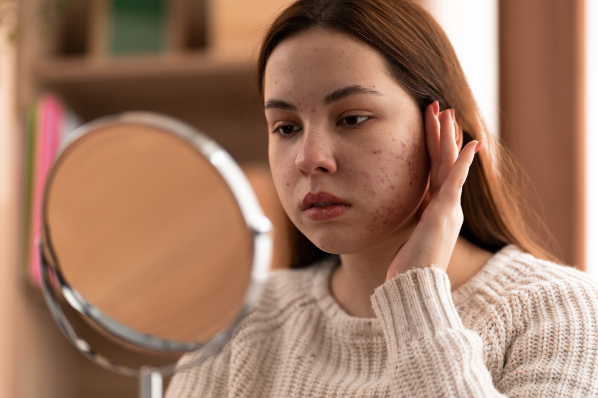 pakai niacinamide malah jerawatan