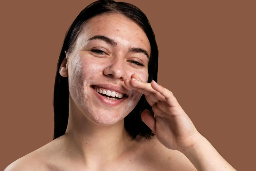 Kandungan sunscreen untuk kulit berjerawat.