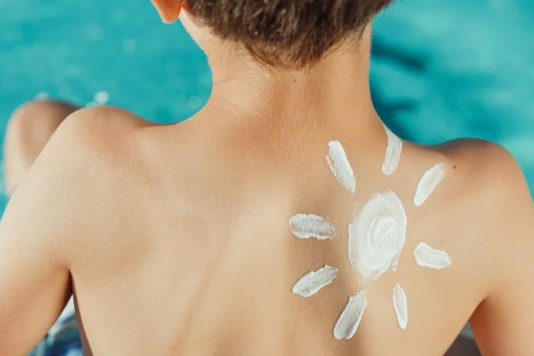 Sunscreen Physical untuk Kulit Apa? Cari Tahu Kebenarannya!